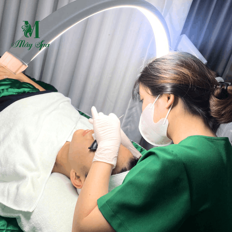 Quy trình nặn mụn y khoa chuyên nghiệp tại Quận Tân Phú