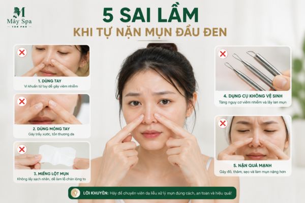 sai lầm khi tự nặn mụn đầu đen