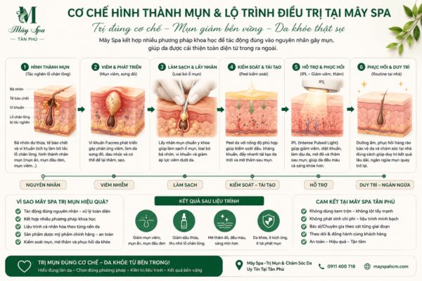 Cơ chế hình thành mụn và lộ trình điều trị tại Mây Spa