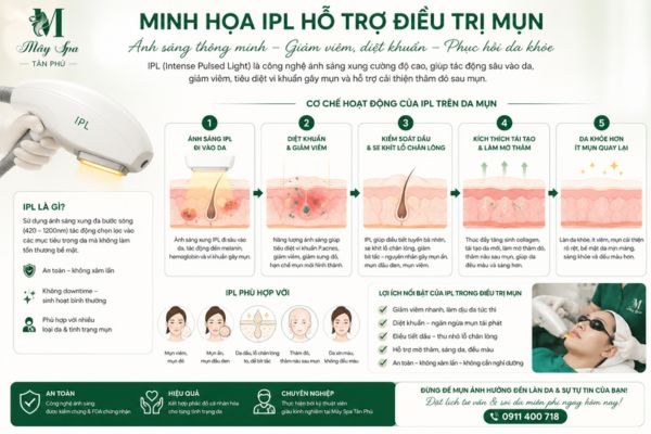 IPL hỗ trợ giảm viêm mụn tại Mây Spa Tân Phú