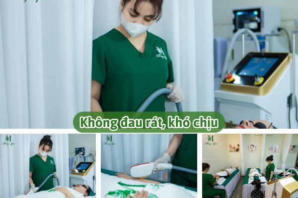 quy trình triệt lông diode laser tại Mây spa Tân Phú