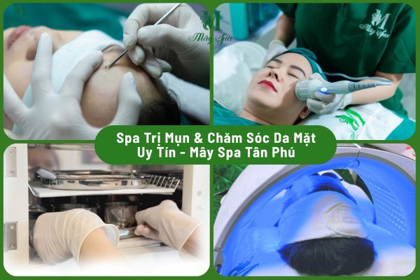 Spa trị mụn và chăm sóc da mặt uy tín tại Tân Phú - Mây Spa Tân Phú