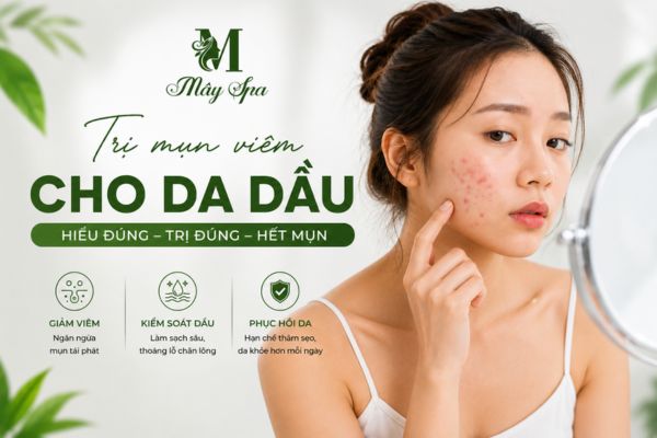 Trị mụn viêm cho da dầu bằng phương pháp khoa học tại Mây Spa Tân Phú