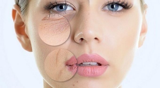 Chống l&atilde;o h&oacute;a da n&ecirc;n bắt đầu từ tuổi 25 ở phụ nữ