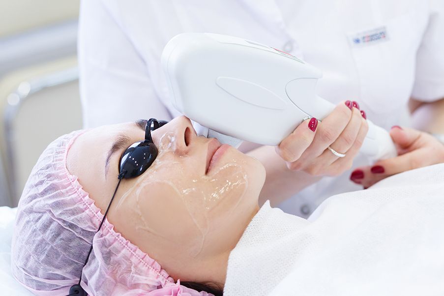 Combo nặn mụn chuy&ecirc;n s&acirc;u + IPL điều trị mụn vi&ecirc;m l&acirc;u năm hiệu quả