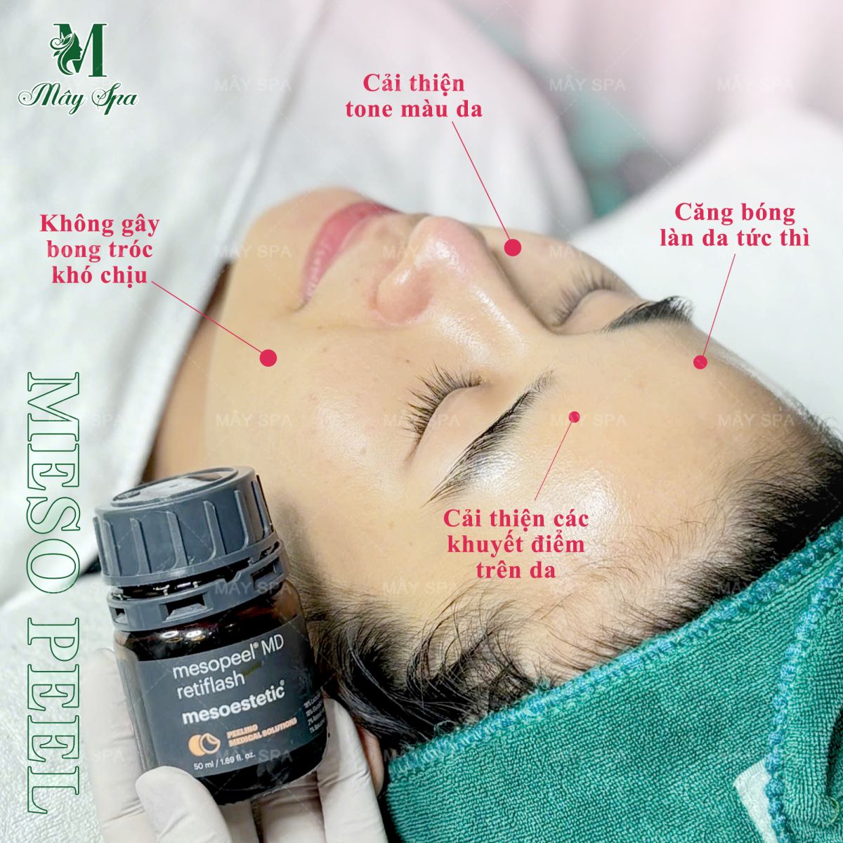 C&aacute;c c&ocirc;ng dụng của Mesopeel