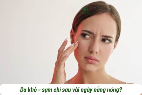 da kh&ocirc; sạm m&ugrave;a h&egrave; do tia UV