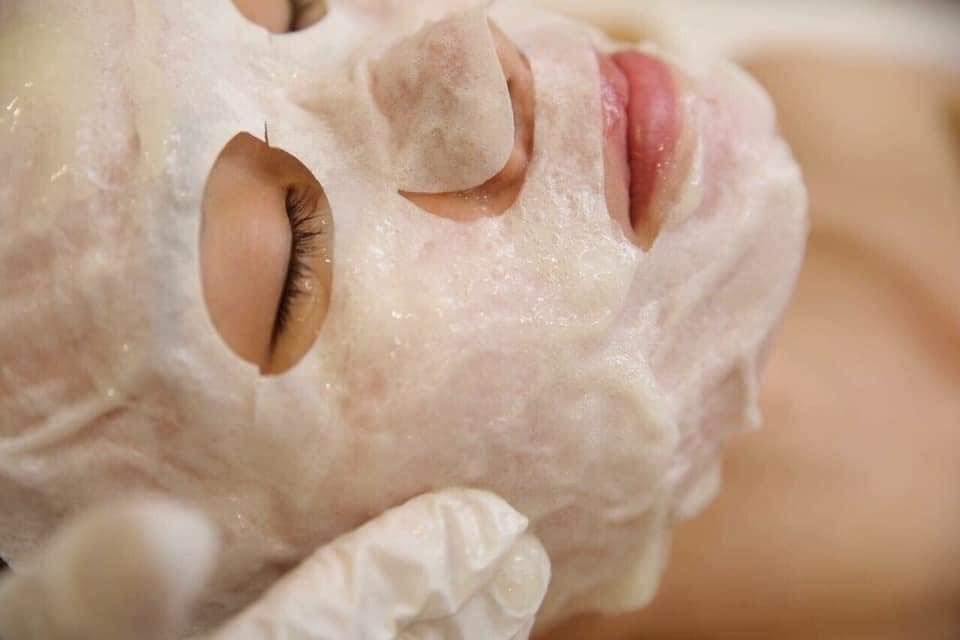 Detox co2 cải thiện đ&aacute;ng kể triệu chứng mụn