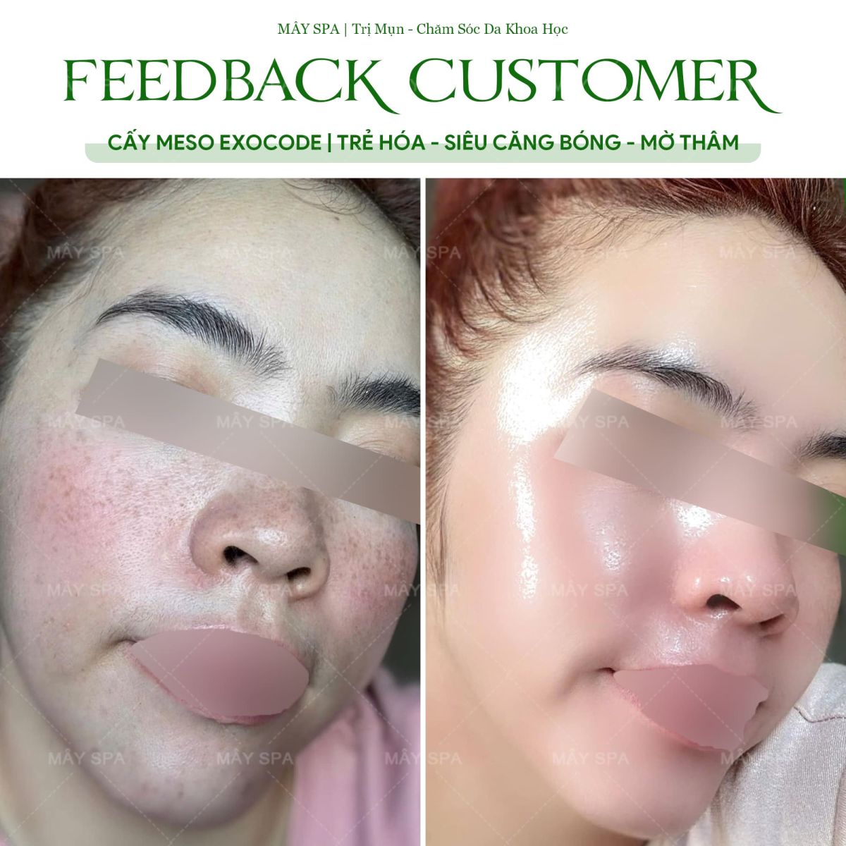 Feedback kết quả chăm sóc da mặt tại Mây spa Tân Phú