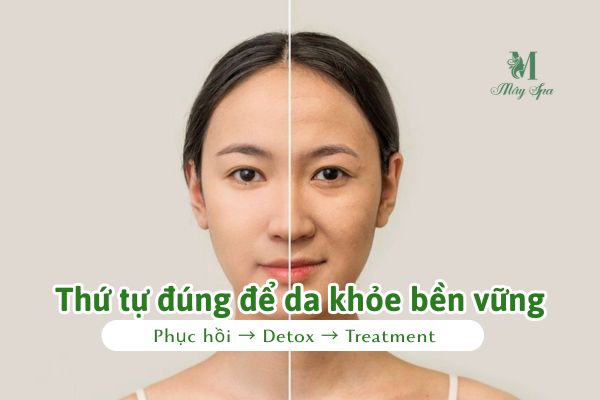 Lộ trình phục hồi da trước khi sử dụng treatment mạnh