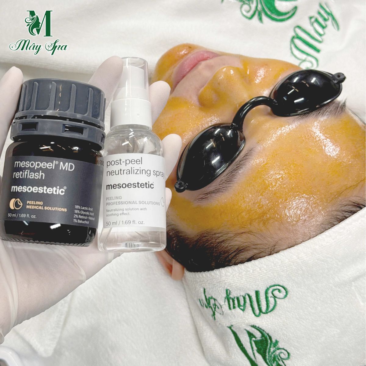 Mesopeel - Giải ph&aacute;p peel da chuy&ecirc;n s&acirc;u