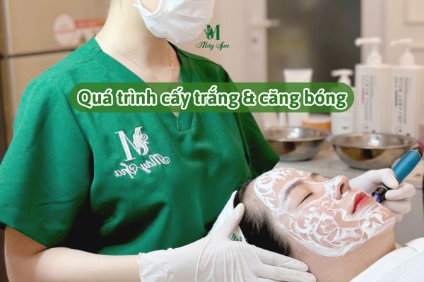 cấy trắng da tại spa Tân Phú