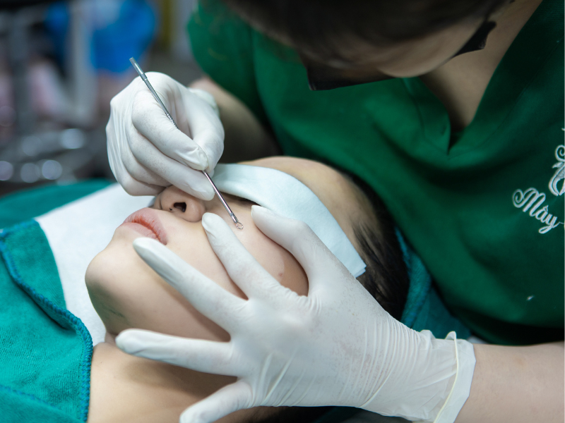 Quy tr&igrave;nh lấy nh&acirc;n mụn kh&ocirc;ng sưng tại T&acirc;n Ph&uacute;