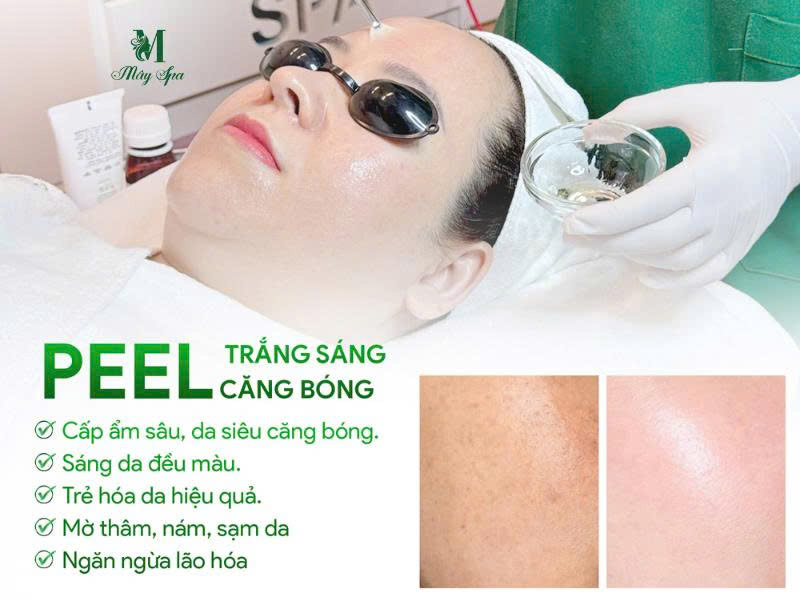 Nên chọn peel da tại spa uy tín 
