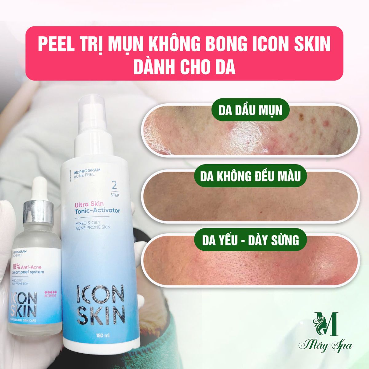 Peel Icon Skin gi&uacute;p nhanh gom cồi mụn, ngừa mụn mới quay lại hiệu quả