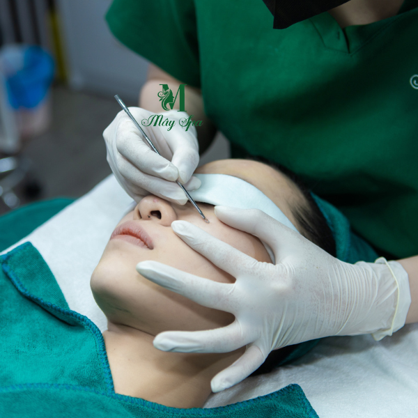 Spa nặn mụn chuẩn y khoa uy t&iacute;n tại B&igrave;nh Thạnh