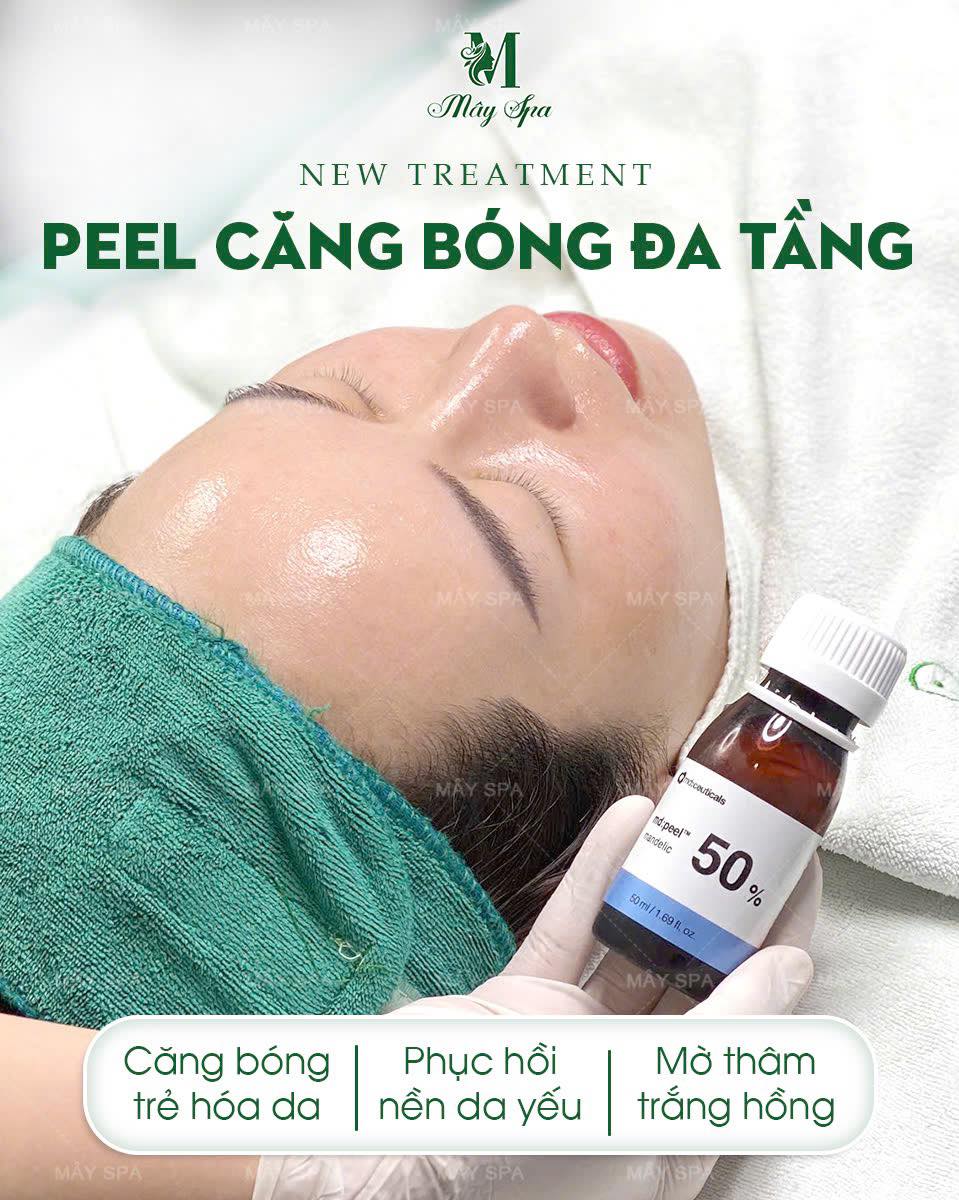 Peel căng b&oacute;ng đa tầng đang được ưa chuộng tại M&acirc;y Spa