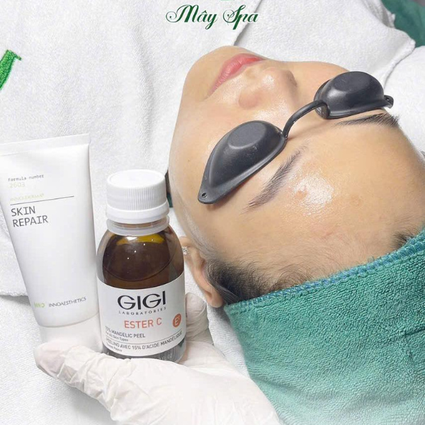 Peel da trị mụn bằng dược mỹ phẩm rất an to&agrave;n
