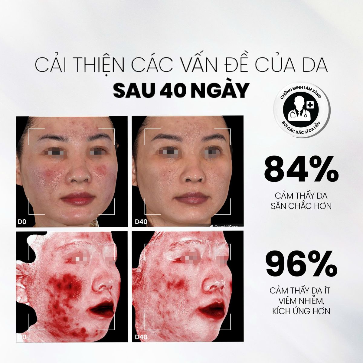 Serum NMF Prebiotics lu&ocirc;n được tin tưởng sử dụng trong Routine b&ocirc;i thoa tại nh&agrave;