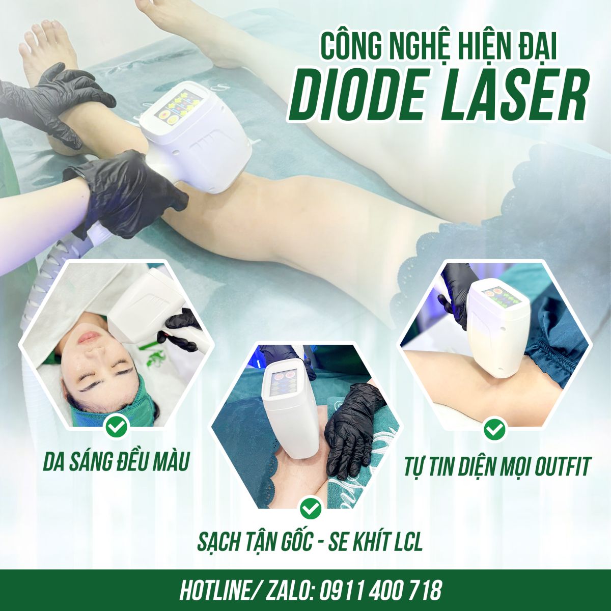 Spa T&acirc;n Ph&uacute; - M&acirc;y spa - Triệt l&ocirc;ng c&ocirc;ng nghệ Diode Laser an to&agrave;n, hiệu quả