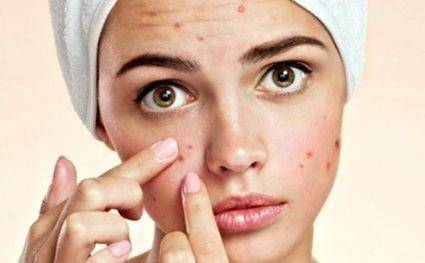 Hướng Dẫn Cách Skincare Tại Nhà Dành Cho Da Mụn