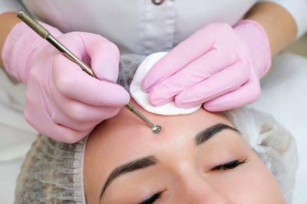 Bao Lâu Nên Đi Lấy Nhân Mụn