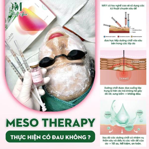 MESO THERAPY – GIẢI PHÁP CHO LÀN DA KHỎE ĐẸP TỪ SÂU BÊN TRONG | MÂY SPA