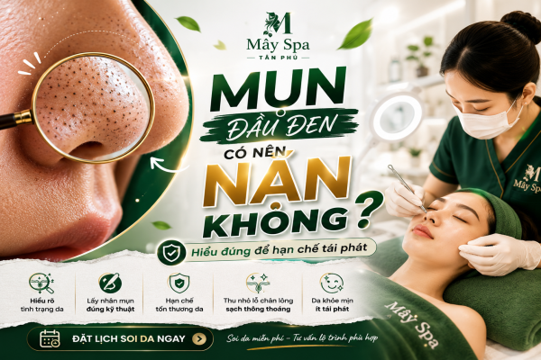 MỤN ĐẦU ĐEN CÓ NÊN NẶN KHÔNG? CÁCH XỬ LÝ ĐÚNG ĐỂ HẠN CHẾ TÁI PHÁT