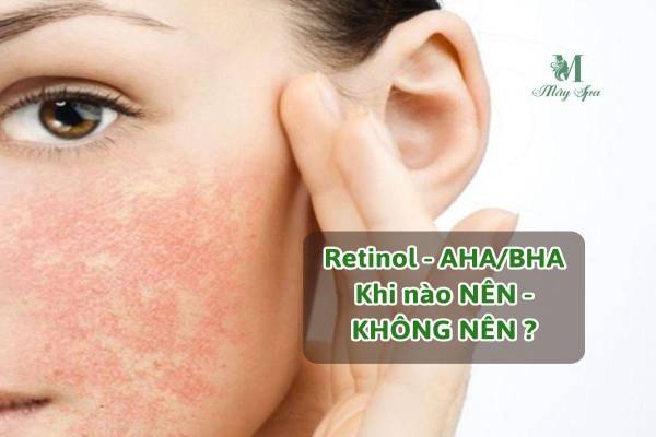 Hoạt chất Treatment và bẫy phục hồi da sau Tết: Hiểu đúng về Retinol, AHA/BHA trong trị liệu chuyên nghiệp
