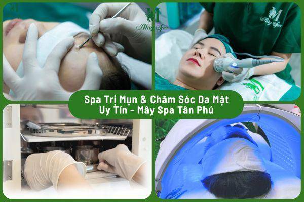 Spa trị mụn và chăm sóc da mặt uy tín tại Tân Phú – Mây Spa Spa trị mụn và chăm sóc da mặt uy tín tại Tân Phú – Mây Spa