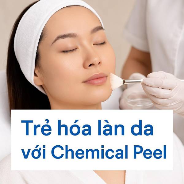 Chống Lão Hóa Bằng Chemical Peel
