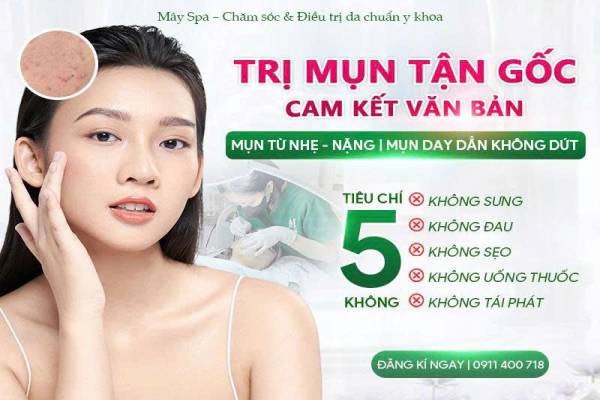 TRỊ MỤN DỨT ĐIỂM – TRỌN GÓI, KHÔNG PHÁT SINH, CHUẨN Y KHOA