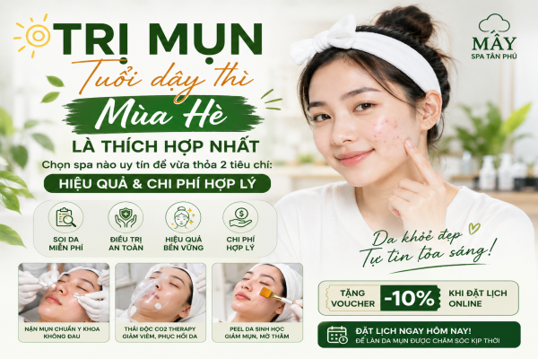 Trị Mụn Tuổi Dậy Thì Mùa Hè: Thời Điểm Vàng Để Cải Thiện Làn Da Và Chọn Spa Uy Tín Trị Mụn Tuổi Dậy Thì Mùa Hè: Thời Điểm Vàng Để Cải Thiện Làn Da Và Chọn Spa Uy Tín