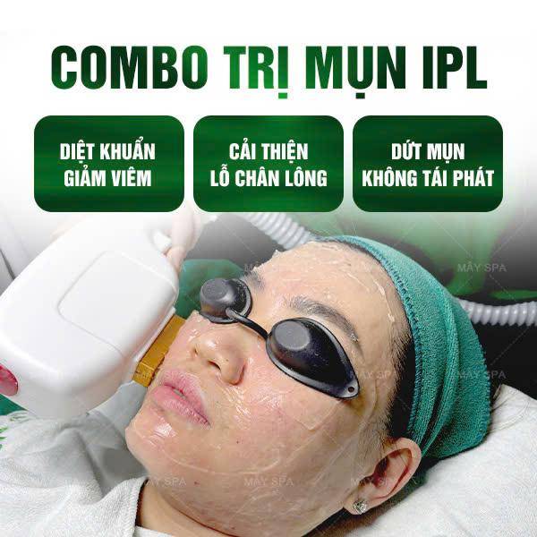 Combo Nặn Mụn + Bắn IPL - Trị Mụn Viêm, Giảm Sưng Đỏ