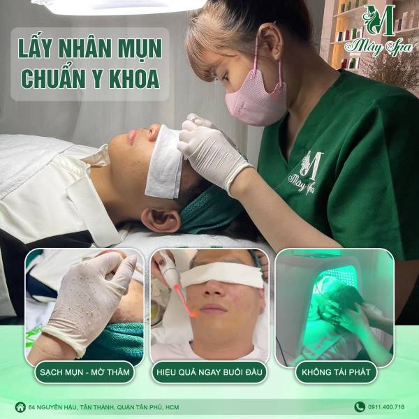 Lấy Nhân Mụn Chuyên Sâu Chuẩn Y Khoa - Không Để Lại Thâm, Sẹo
